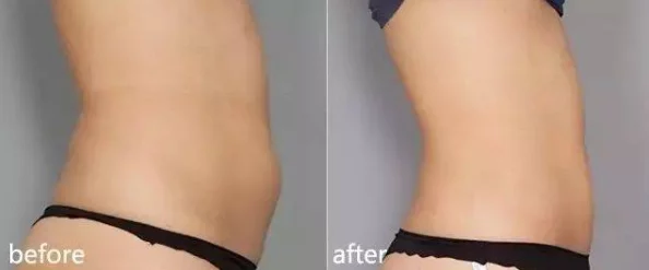 他撕开她的内裤猛地挺进最新研究表明这种行为可能导致心理创伤