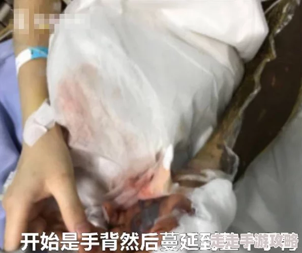 请主人打烂贱奴的屁股沟主人已经用鞭子抽打肿胀并留下淤青 请主人打烂贱奴的屁股沟主人已经用鞭子抽打肿胀并留下淤青