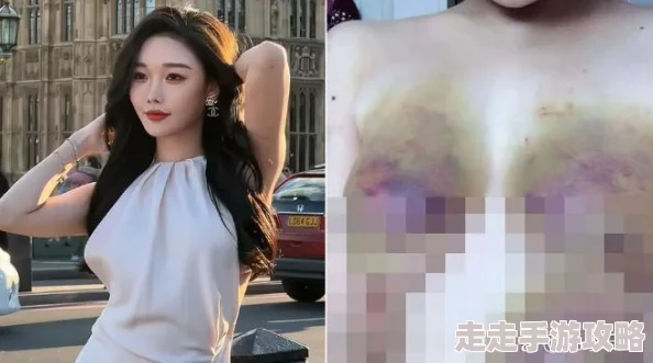 雅典娜缸体破裂视频为什么迅速走红网络为何引人注目